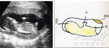 怀孕十三周胎儿性别图图片